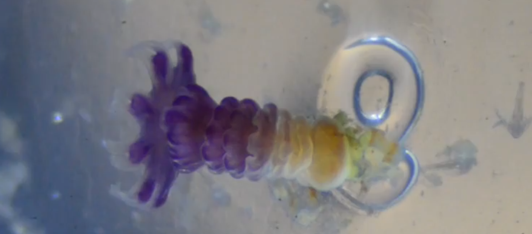 Jelly Strobulation Still